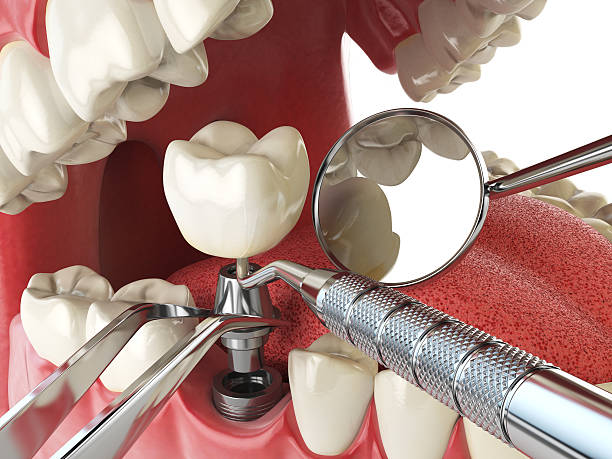 Best Weekend Emergency Dentist in Canadian Lakes, MI